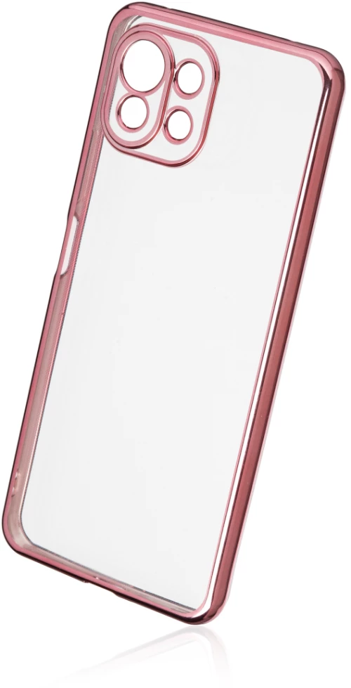 Naxius Plating Case Pink Xiaomi Mi 11 Lite Naxius