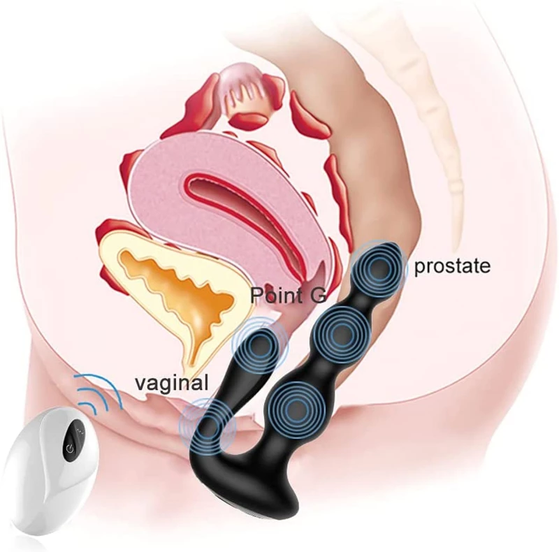 Remote Silicone Anal Beads