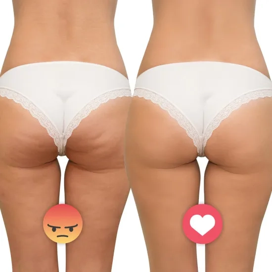 Συσκευή Μασάζ Ultrasonic Massager inSPORTline Valeri