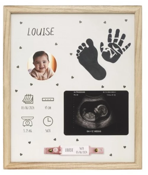 Petit Artichaut Birth frame PA2601
